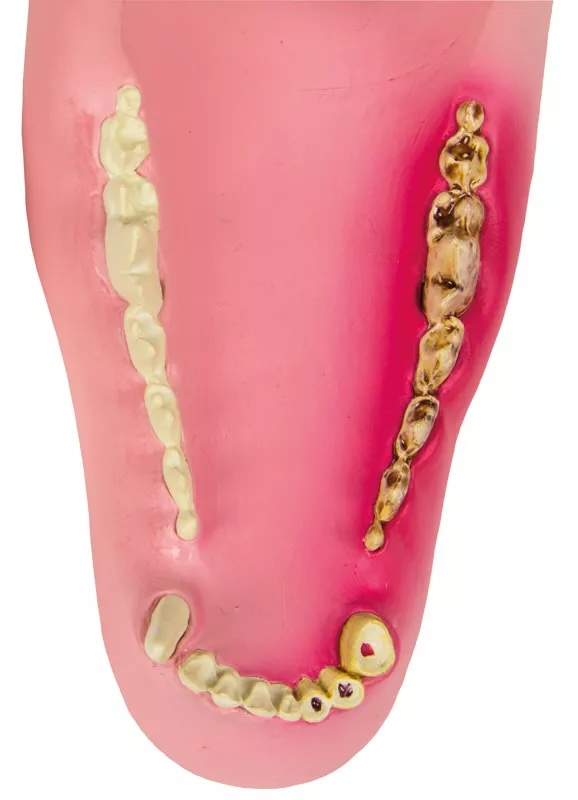 Mâchoire canine saine/malade