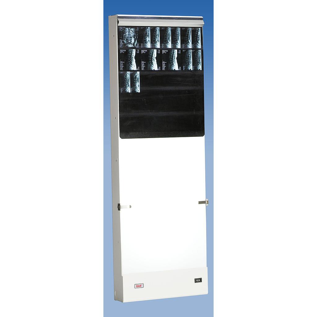 [107-133] Single Trimline Spinal X-ray viewer - 35 cm (14") x 91 cm (36") - reg. $ 499.00 {↓}